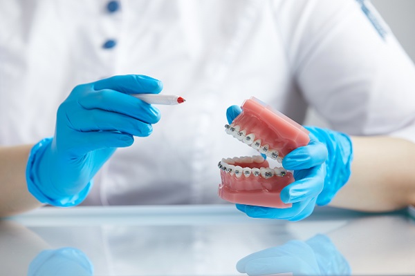 What Are The Benefits Of Getting Braces?