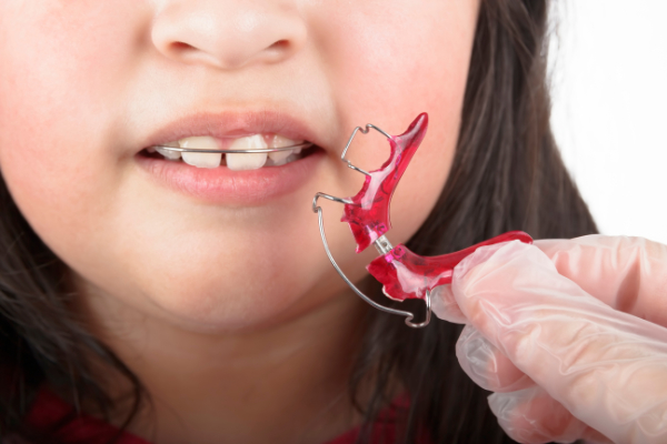 Common Pediatric Orthodontic Issues And How They Can Be Fixed