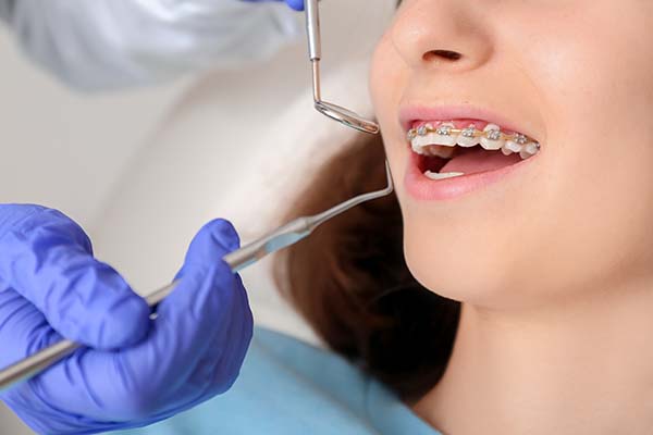 Teeth Straightening Treatments From An Orthodontist