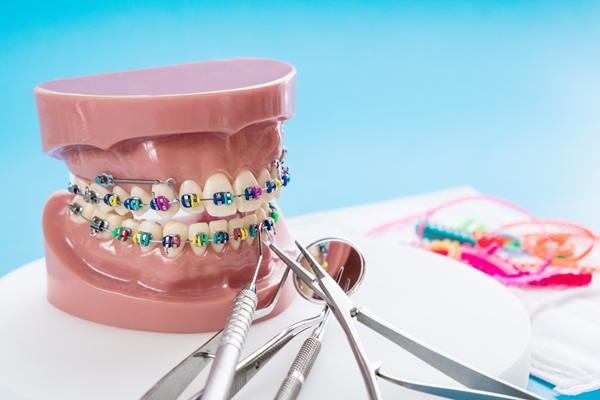Reasons To Choose Traditional Metal Braces